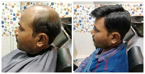 Hair Patch in Tilak Nagar Delhi-

The Ha