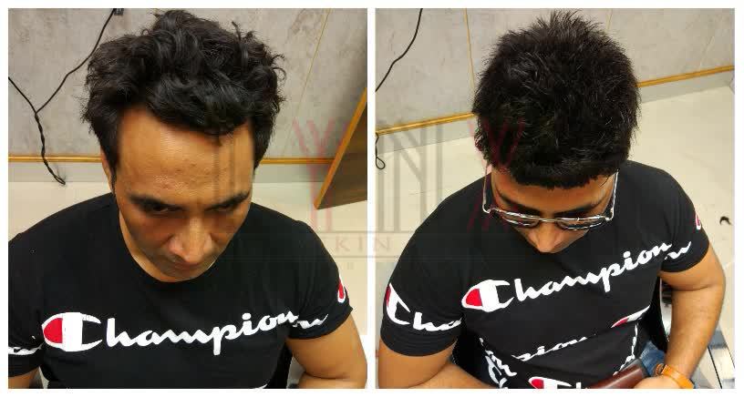 Hair Patch in  Sultanpuri Delhi-

The Ha