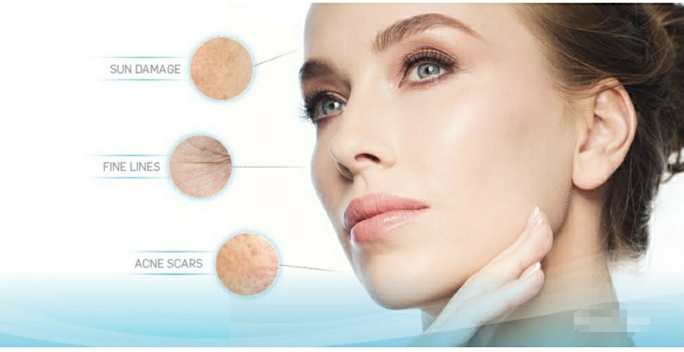 skin rejuvenation treatment