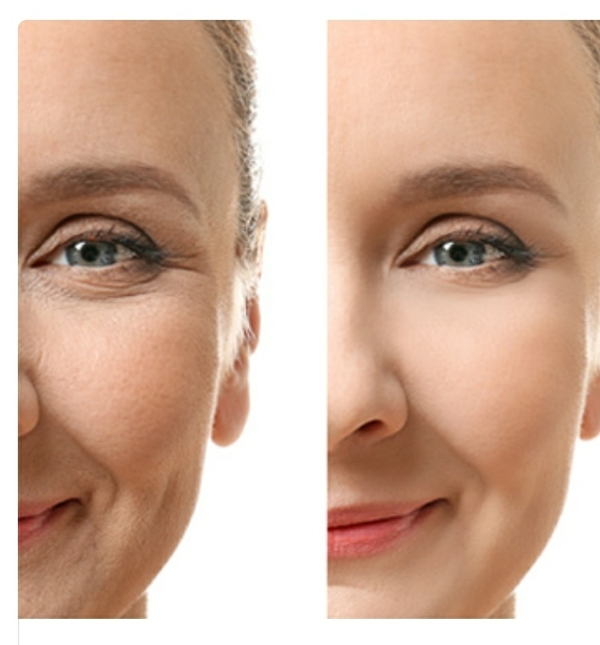 skin elasticity