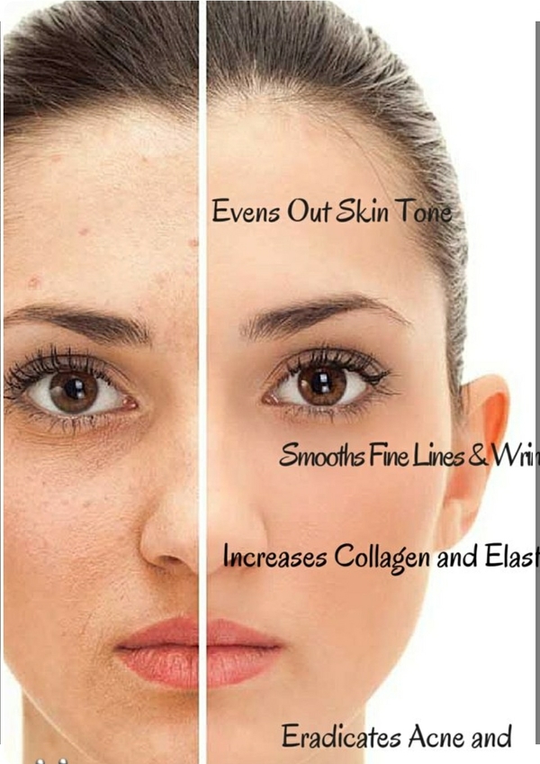 cosmetic procedures