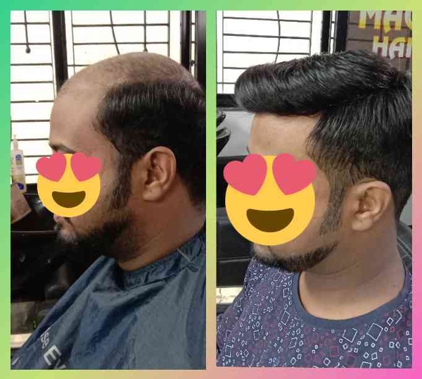 Hair patch and hair wig Center In Nagpur 8806 Magic Hair Weaving Centre
