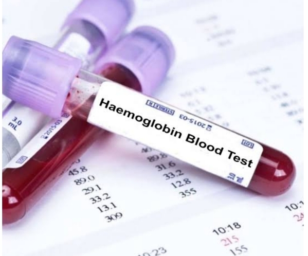 CBC ???
@diagnosticcentrepune.