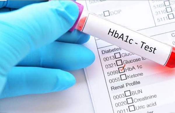 HbA1c ???
@ diagnosticcentrepu