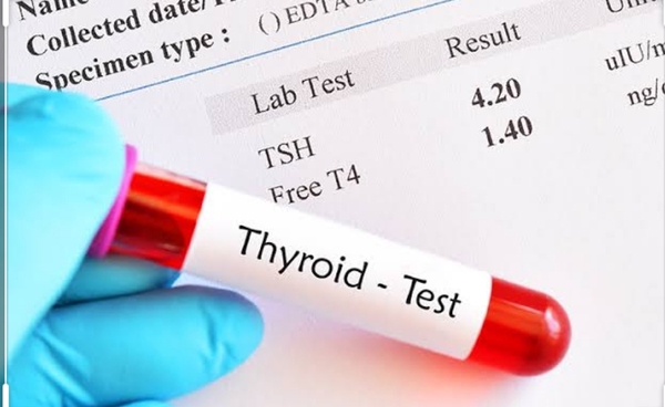TFT's. ???
Thyroid function te