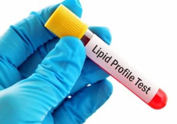 Lipid Profile Test ???
At