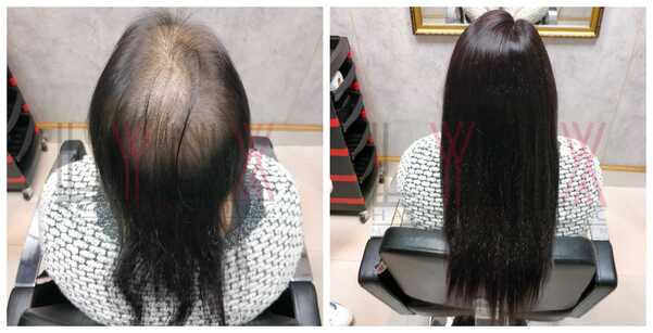 Ladies Hair Wigs in Jaipur-
Today's life