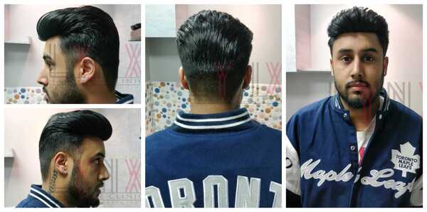 Hair Replacement in Gurgaon-
Hair loss h