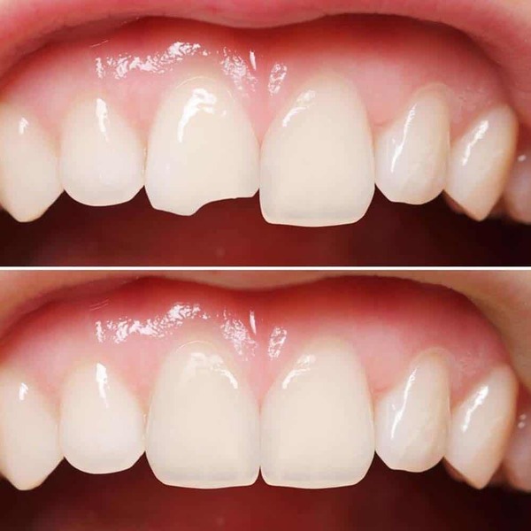 Latest Updates Shree Dental Speciality Hospital,Kalyan