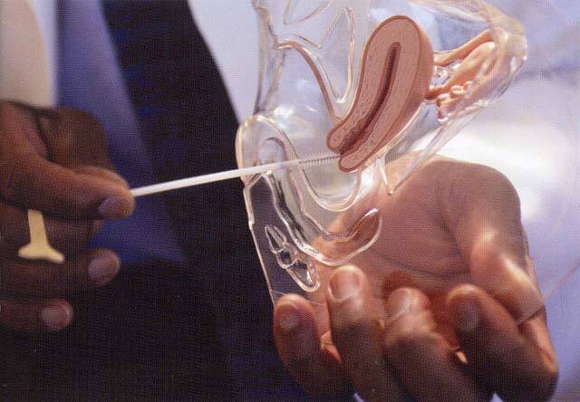 obstetric gynecology