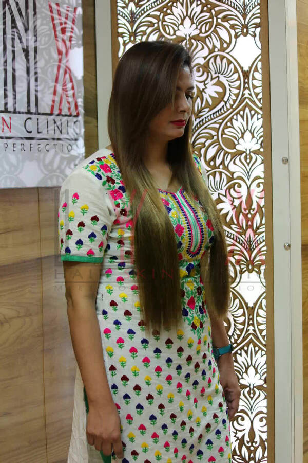 Hair Extensions in Sanathnagar Hyderabad
