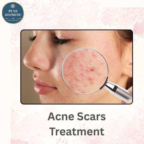 advanced regenerative solution