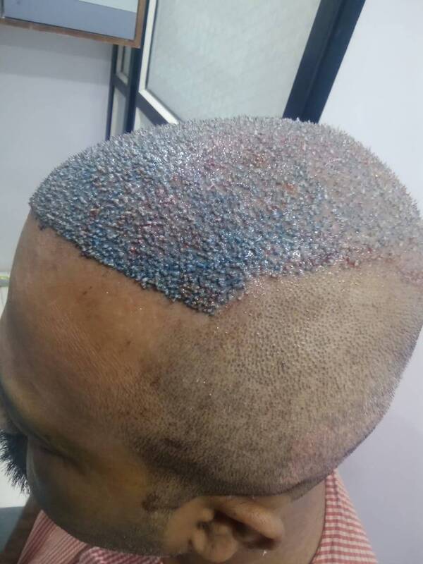 hairtreatment