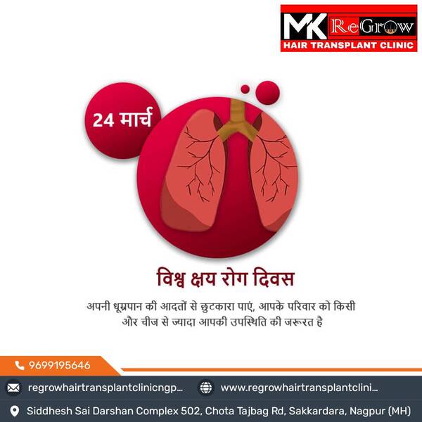 Hair Transplant
Visit on :- h