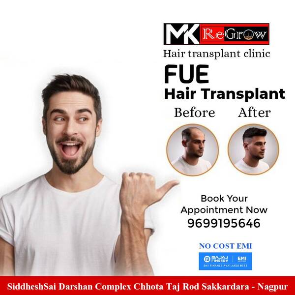 hair transplant nagpur