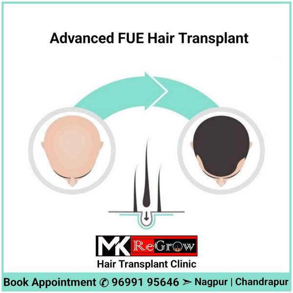 hairlosstreatment