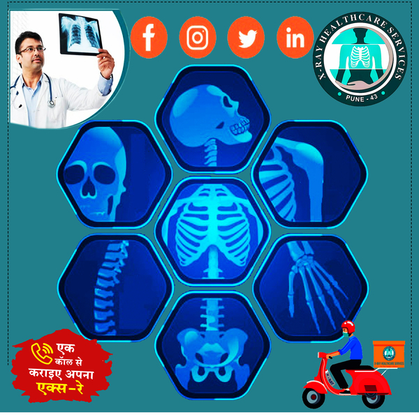 digital radiographic image