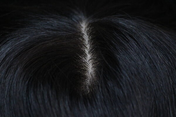 Benefits of Hair Fixing in Bangalore-
1)