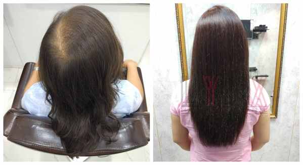 Hair wigs in Kolkata-
There are so plent