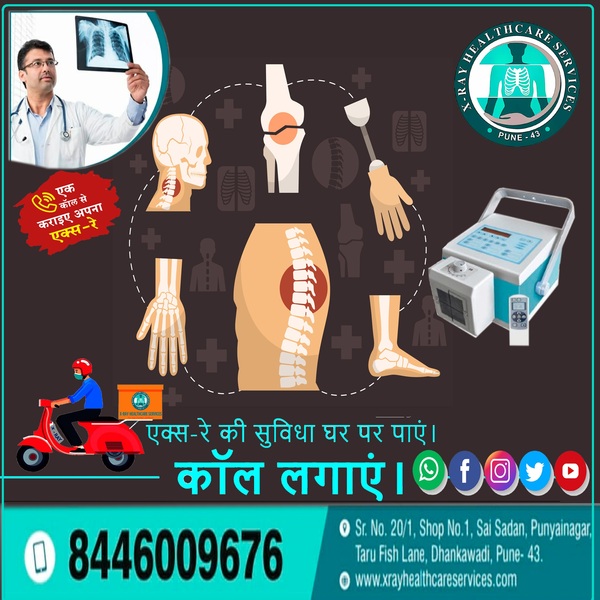 kidney issues ketones