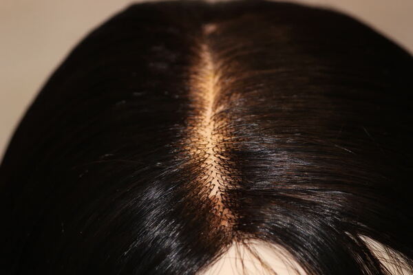 Benefits of Hair Fixing in Jaipur-
1) It