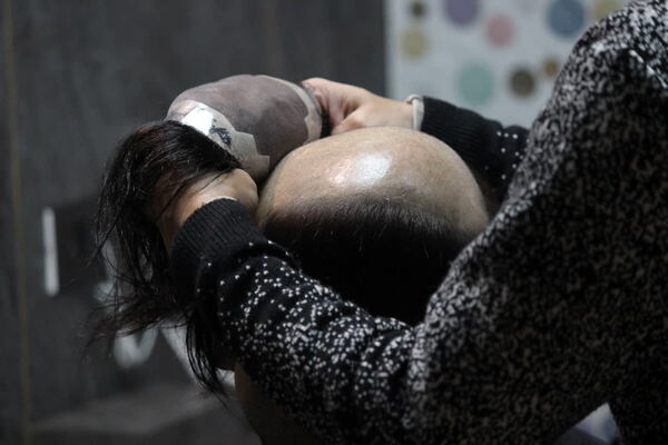 Benefits of Hair Fixing in New Delhi-
1)