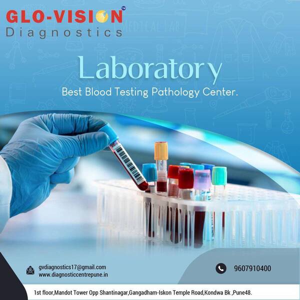 Glo-vision Diagnostics
Glo-vi