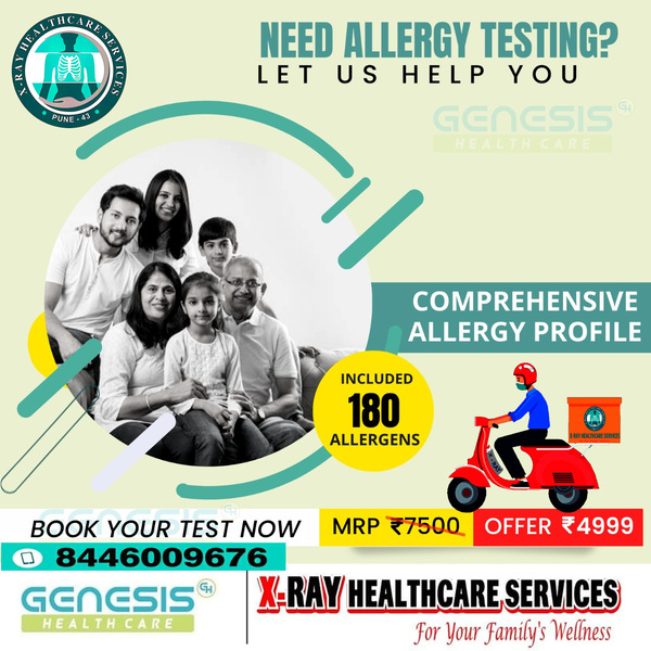 allergy test