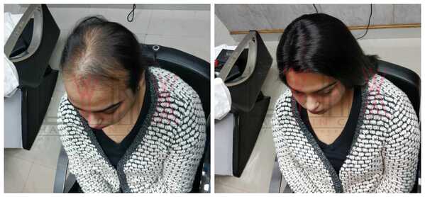 Hair wigs in Navi Mumbai-
There are so p