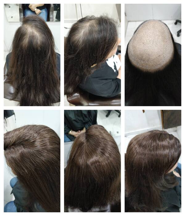 Hair wigs in Bangalore-
There are so ple