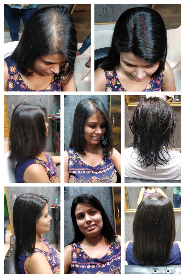 Ladies Hair Patch in Bangalore-

Due to 
