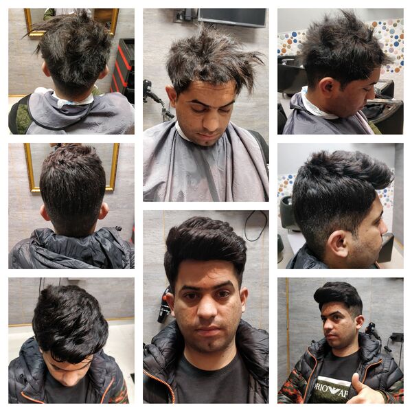 Hair Fixing in Bangalore-

The hair on a