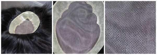 Hair Fixing Treatment in Bangalore: Proc