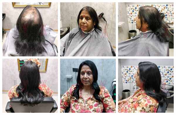 Hair Bonding Procedure in Bangalore-

Sc