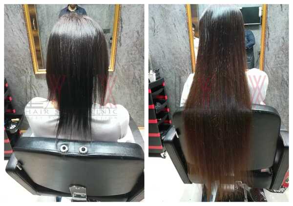 Hair Extensions Cost in Bangalore-

Hair