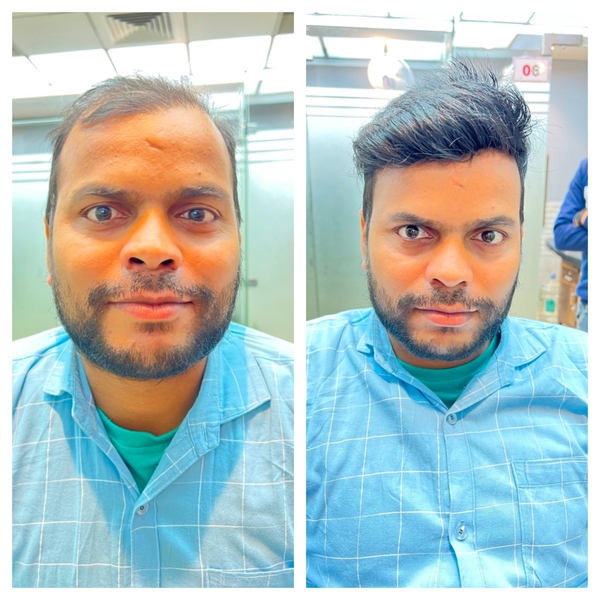 Benefits of Hair Bonding in Gurgaon-

Do