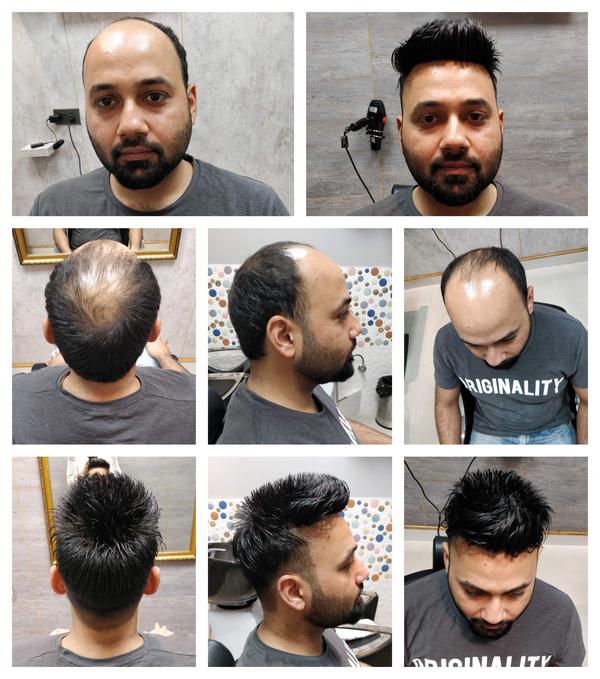 Hair Patch in Mohali-

Going bald can ha