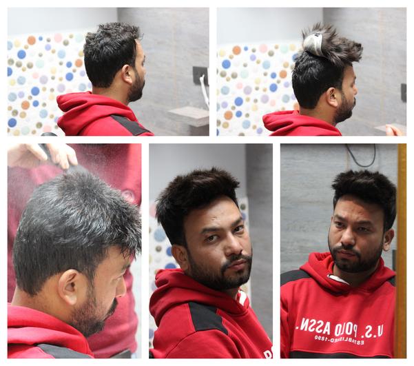 Hair Patch in Panchkula-

Going bald can