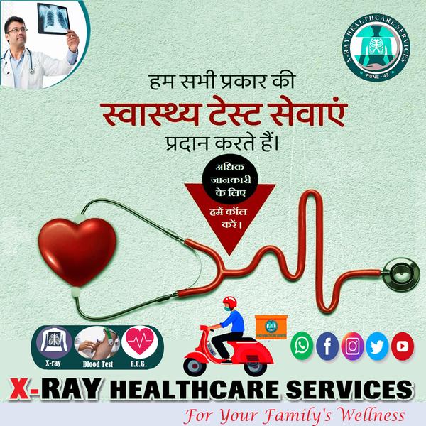 accurate digital x ray testing