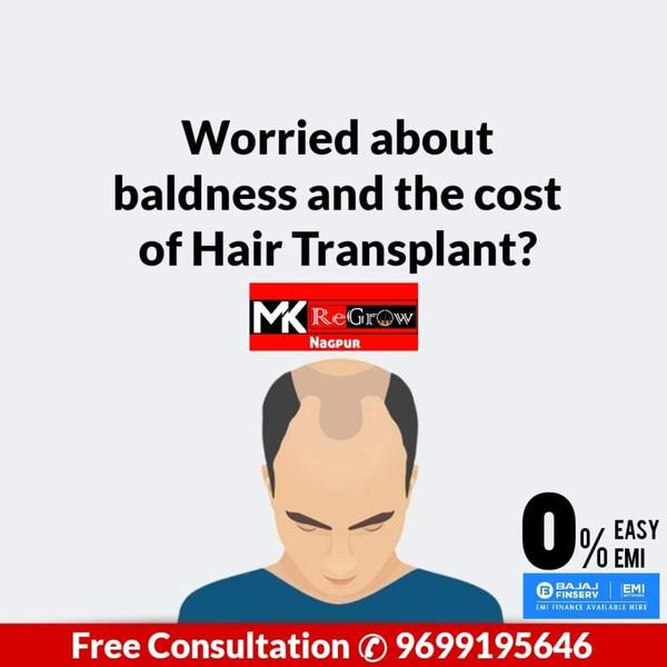 hairtransplantnagpur