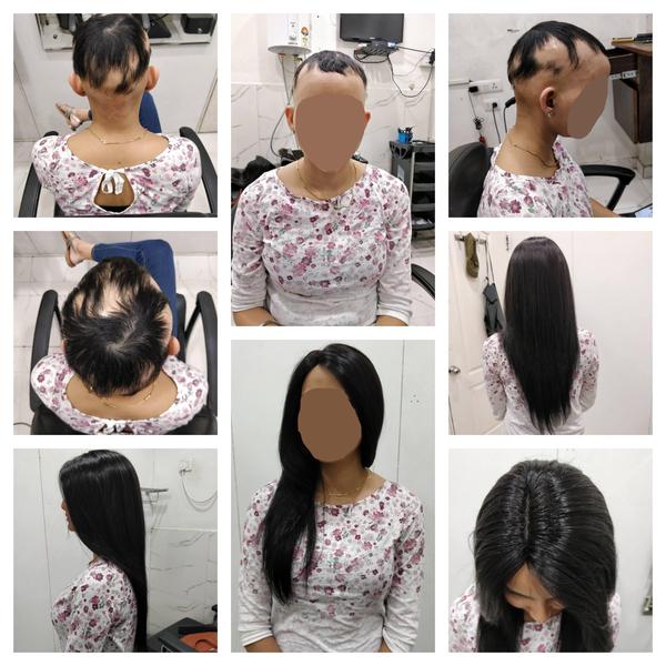 Hair wigs in Kurnool-
There are so plent