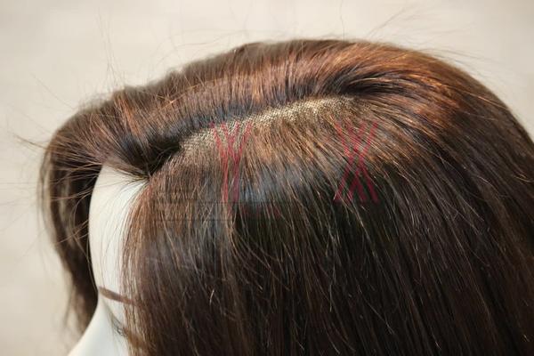 Hair wigs in Ullal, Bangalore-
There are