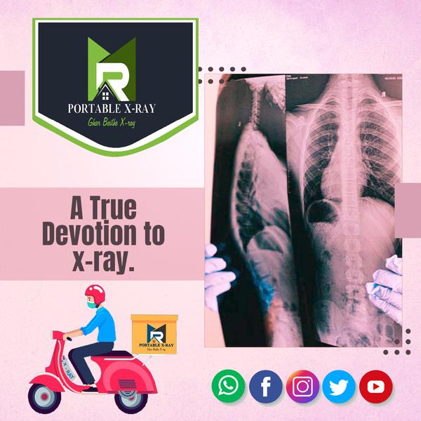 MR PORTABLE X-RAY
A True Devot
