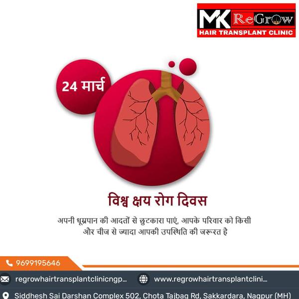 nagpur hair transplant clinic