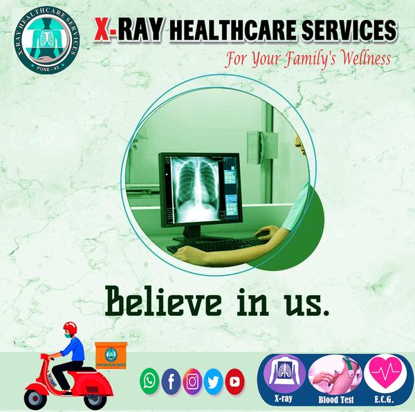 advanced kidney profile iron s