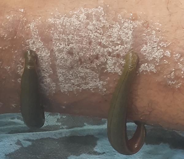 update image
