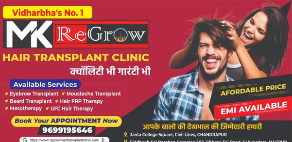 nagpur hair transplant mk
