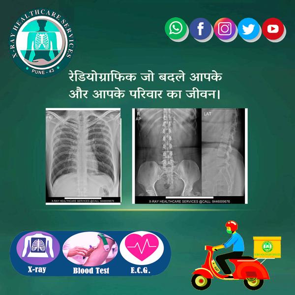 digital x ray at home pune