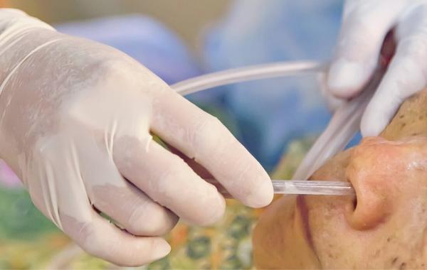 ryles tube feeding