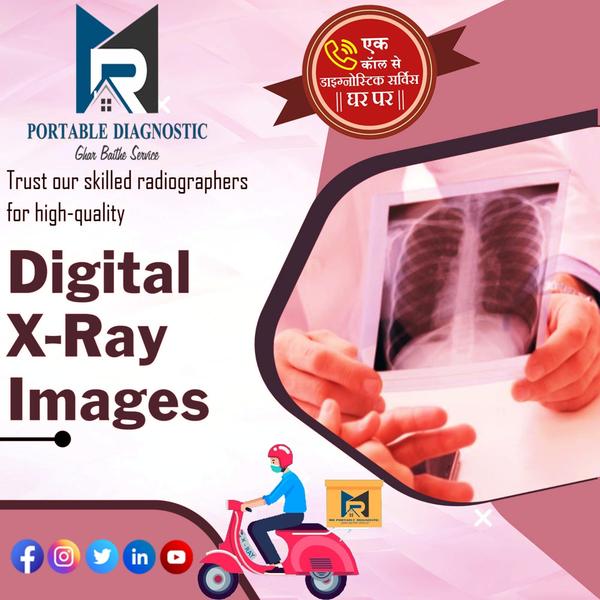 digital x rays